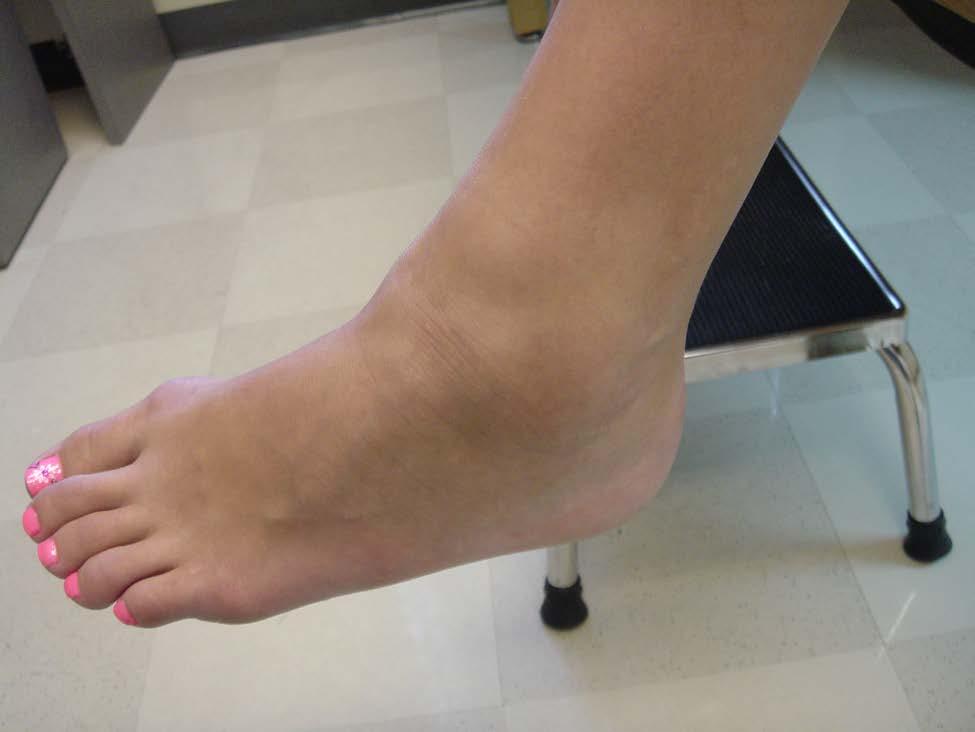 Is this ankle