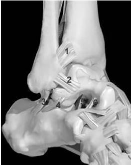 Lateral Collateral Ligaments Anterior talofibular ligament (2) Weakest: Damage almost all ankle sprains. Restrains ant. Translation and Int. rotation of talus.