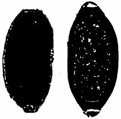 Figure 3. Comparison of Capillaria philippinensis and Trichuris trichiura eggs as seen in stool specimens.