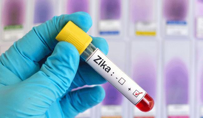 Diagnosis of Zika Virus Definitively established via reverse-transcription