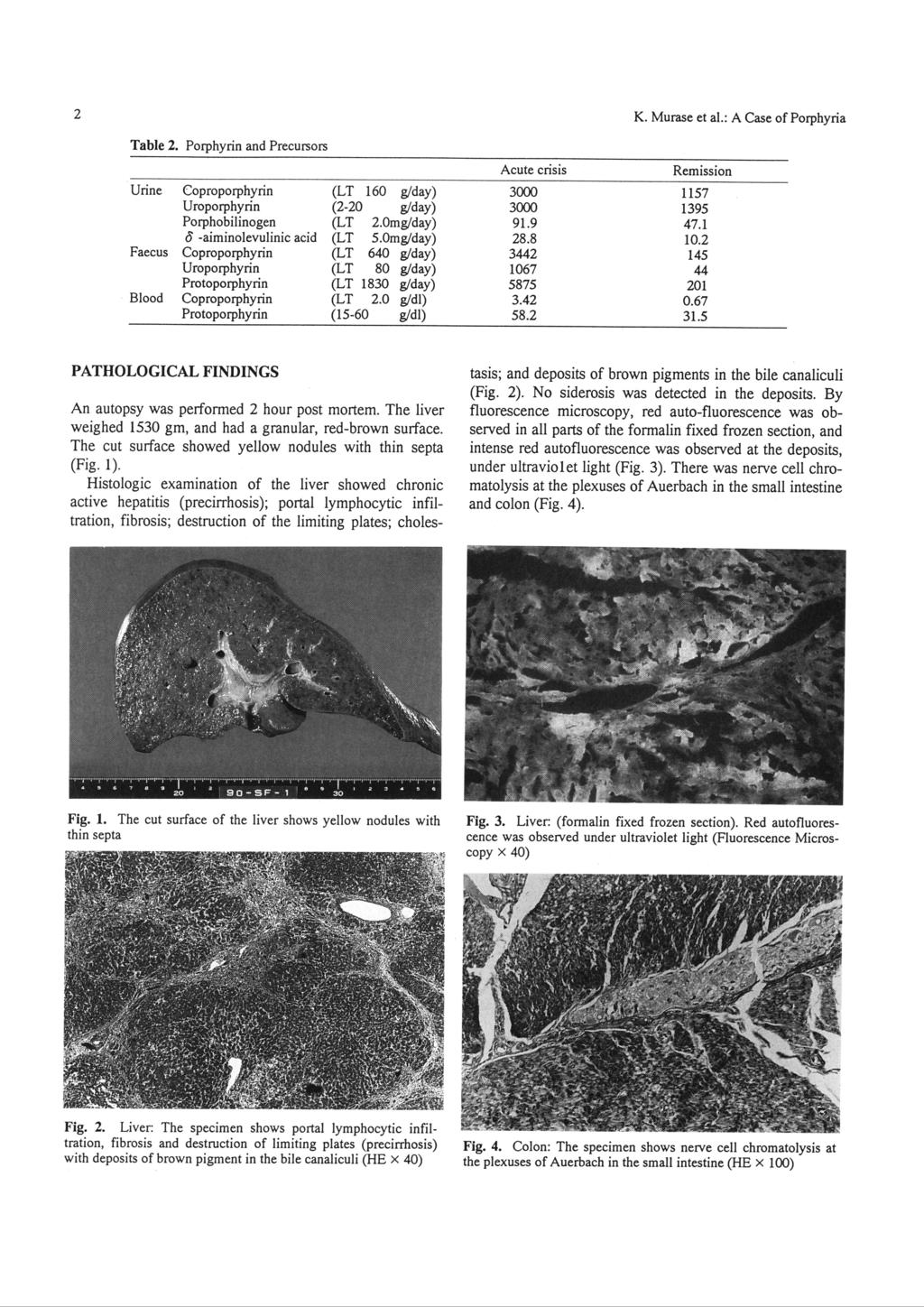 2 K. Murase et al. A Case of Porphyria Table 2.