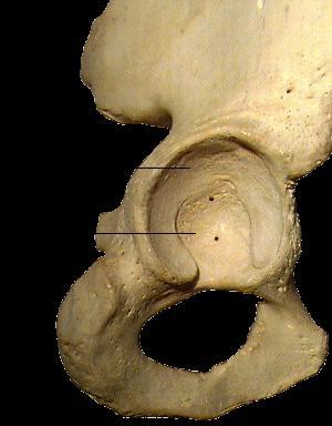 It is a cup-shaped cavity on the lateral aspect of the hip.