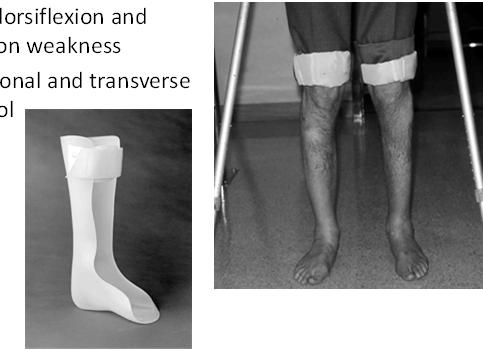 Solid Ankle AFO Indications: Combined dorsiflexion and plantarflexion weakness Sagittal, coronal and