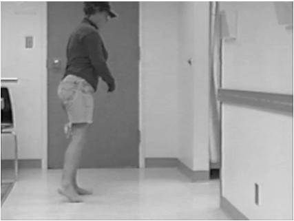 sagittal plane control at the knee by ankle position and control Hyperextension Flexion Case