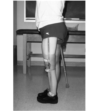 Knee Ankle Foot Orthosis Recurvatum