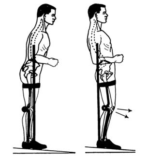 falls posterior to mechanical knee joint axis Knee flexion instability Lister, MJ, Principles LE Bracing, 1967 Lister,