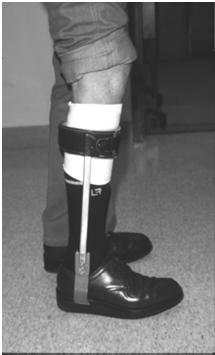 accommodate a plantarflexion contracture AFO Footwear Combination Shank