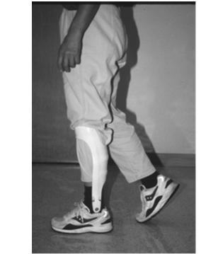 Plantarflexion Weakness AFO with a Dorsiflexion Stop Provides stability in the sagittal plane by controlling tibial advancement during midstance and terminal stance Relationship between adequate