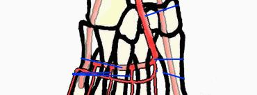 Peroneal Artery