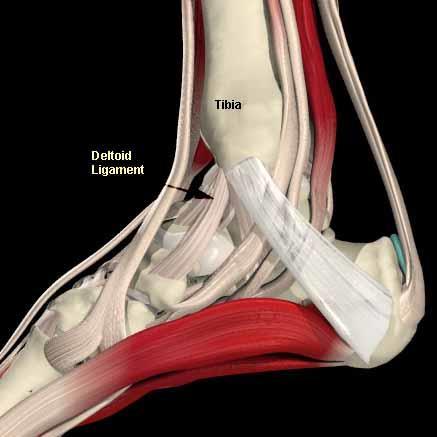 ANKLE JOINT Medial (Deltoid) ligament of the ankle apex attached above to medial malleolus strong and triangular in shape