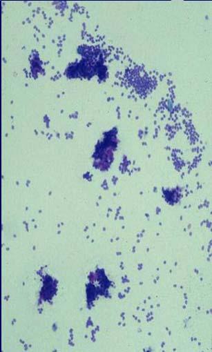 Key Cytologic Features Low power architectural appearance Size of cells