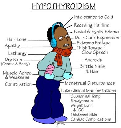 Clinical features of Acquired hypothyroidism Goiter Slow growth, delayed osseous maturation, and increased weight Lethargy Dry skin, and puffiness Sleep disturbance, typically obstructive sleep apnea