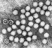 Aseptilise meningiidi tekitajad Viirused Enteroviirused (echo ja Coxackie), arboviirused, herpesviirused, HIV, adenoviirus, paragripi viirus, gripiviirus, leetriviirus Bakterid M.