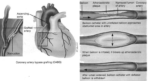 relaxation - High specificity vascular sm - Vasodilation: veins > arteries - Preload > Afterload c.