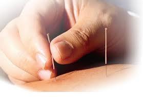 Acupuncture The practice of acupuncture and moxibustion is based on the theory of meridians.