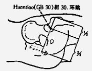 Method: Puncture horizontally 0.3-0.5 cun. 图 57. Fig. 57 5)Fengchi (GB 20) Location: In the depression between the upper portion of m. sternocleido-mastoideus and m. trapezius (Fig. 58).