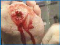 debridement, typically weekly, can expedite the rate of wound healing