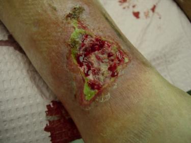 Wound specialists have to be medical