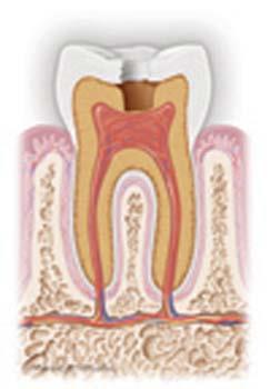 Etiology and Pathophysiology There are 3 requirements for the formation of dental caries: 1. Cariogenic bacteria 2. Sugar 3.