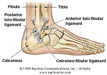 Sprains 4 Rolled ankle. Inversion mechanism. 4ATFL commonly injured.