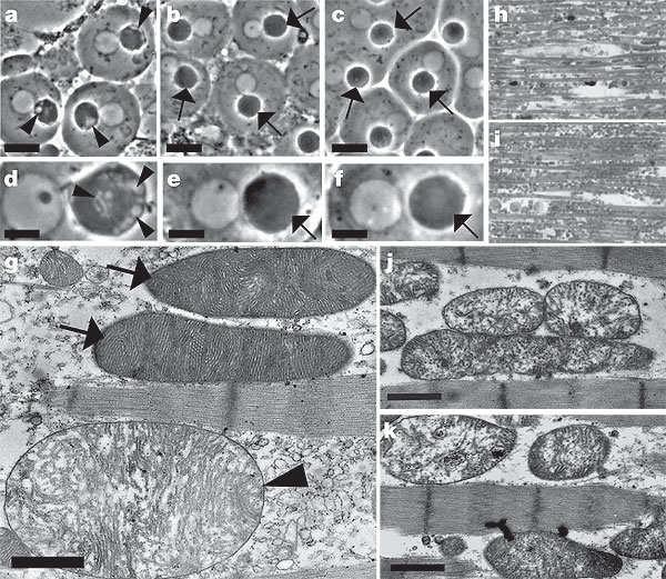 Drosophila other autosomal recessive forms of PD DJ-1 (PARK7) rare?protease/?