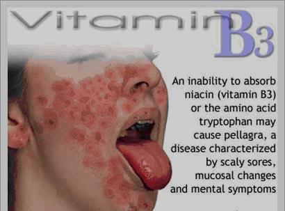 Niacin (Vitamin B 3 ) Is part of the coenzyme nicotinamide