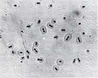 Streptococcus pneumoniae Gram positive diplococcus Capsule is the main virulence factor Prevents phagocytosis Anti-capsular antibodies are protective >90 serotypes Some