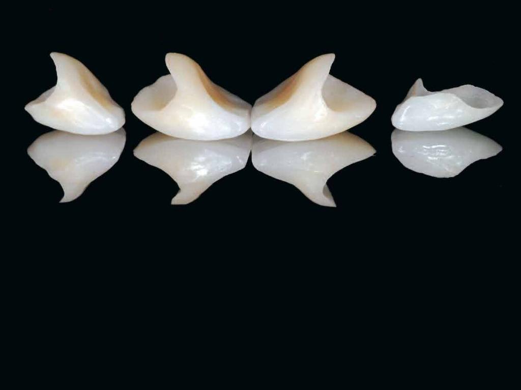 Porcelain Jacket Crowns: Back to the Future Through Bonding Pascal Magne, PhD, DMD 1 Michel Magne, MDT, BS 2 Inge Magne, CDT 2 More than 50 years before bonding to tooth structure (and especially to