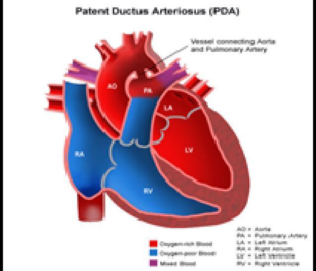 the ductus arteriosus.