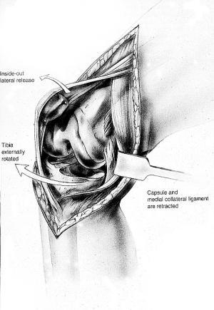 About the Long Axis Patella Medial Tendon Lateral Tubercle