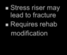 lengthening Exposes IM canal Stress riser may lead