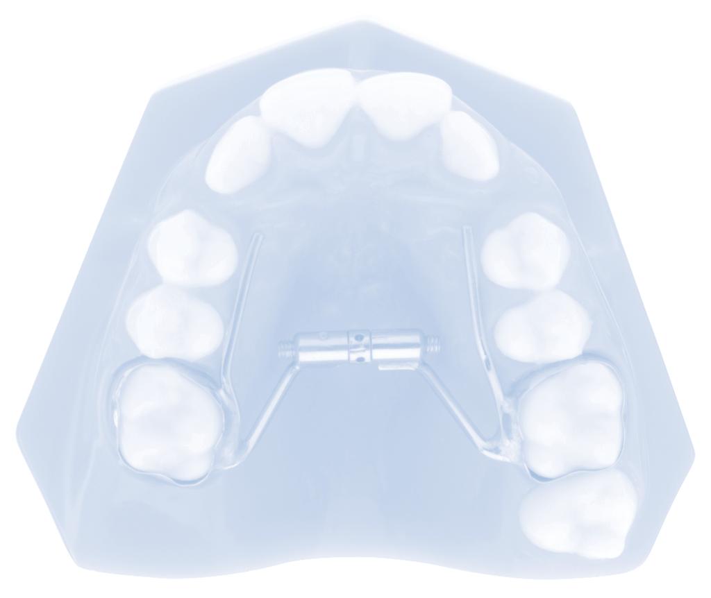 SECTION 11 PAGE 2 ALLESEE ORTHODONTIC APPLIANCES AOA Laboratories Your Trusted Source for a Complete Range of Customized Appliances For more than 30 years, AOA has set the