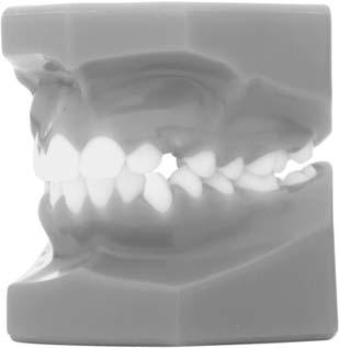 SECTION 11 PAGE 10 ALLESEE ORTHODONTIC APPLIANCES Consultation Typodonts Urethane models in nearly 50 different occlusions are available for demonstration purposes.