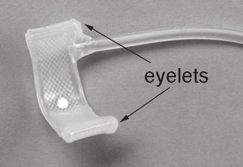 The cuff is closed around the urethra by placing 0-2.0 polypropylene sutures through the eyelets and tying a secure knot.