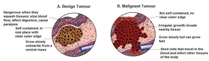 Cancer is dangerous because it can spread and attack healthy organs Diagram showing the difference between a benign and malignant tumour Different Kinds of Cancers 1.