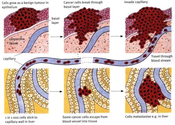 Two Types of Tumors Benign tumour: cell masses that stay at one site; does not spread Malignant tumour: cancerous cells can leave the first site and invade other organs and tissue in a process called