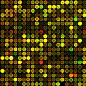 Microarrays Developed in 1995 Genome-wide snapshot of mrna expression In 2001, applied to lung tumors ID of primary tumors vs.