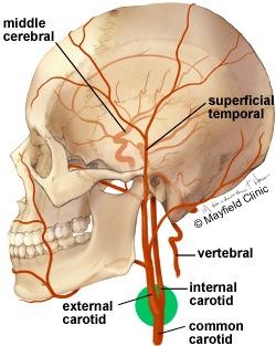 Anatomy The carotid artery begins at the aorta in the chest as the common carotid and courses up through the neck to the head Near the larynx, the common carotid divides into the external and