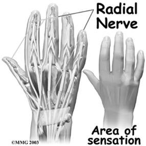 Neuropathy Radial Nerve