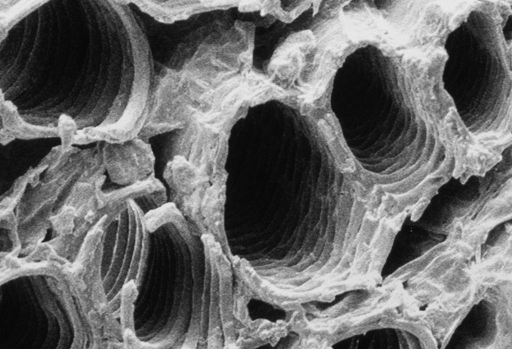 3 Fig. 3.1 shows an electron micrograph of some xylem vessels in tobacco leaf fragments in a cigarette. 7 magnification = 395 Fig. 3.1 (a) (i) Describe and explain two features of the xylem vessels, visible in Fig.