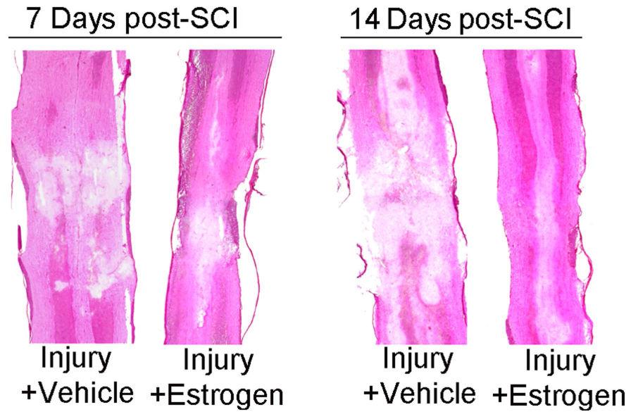 Samantaray et al. Page 19 Fig. 2. Low dose estrogen therapy preserves tissue integrity following chronic SCI.