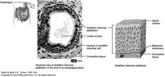 Columnar cells in apical layer only Basal layers has shorten, irregular shaped cells