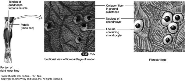 Fibrocartilage Chondrocytes are scattered among bundles of