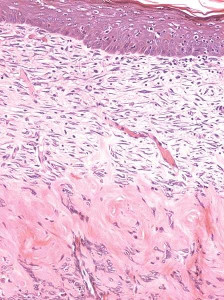 Section of rat skin. The subepithelial connective tissue (dermis) is loose connective tissue. In this area, the cells, most of which are fibroblasts, are abundant.