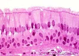 Pseudostratified ciliated columnar epithelium appears layered,