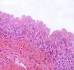 Transitional epithelium contains rounded cells that, when