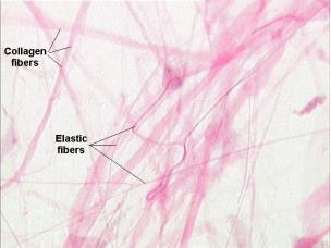 Reticular fibers Macrophage Blood Vessel Mast cell Elastic fibers Macrophage Collagen