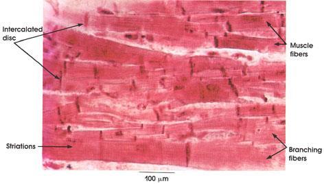 Skeletal muscle tissue is made of large, multinucleated cells that can be up to