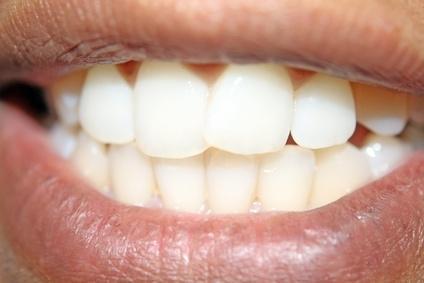another set of teeth called permanent teeth, or adult teeth.