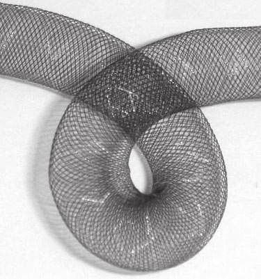 Kulcsár et al Flow Diversion for Basilar Artery Aneurysms 1691 parent-vessel curvature. Additional coiling was performed in 6 aneurysms.